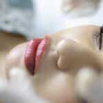 Ojeras y su Impacto en Tu Mirada