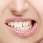 Bruxismo: qué es, cómo identificarlo y cómo tratarlo