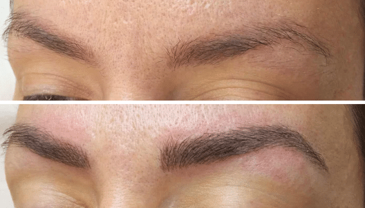 Micropigmentación Jana Lima salud con pigmentos biocompatibles antes y después